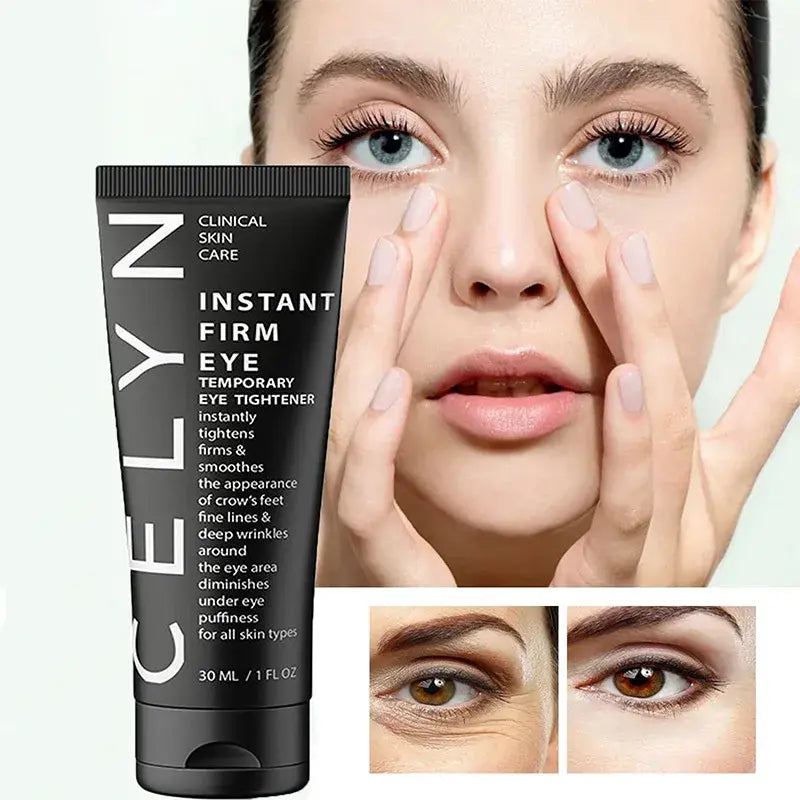 Eye Dark Circles Cream Remover